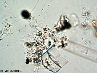 phyto/Scattered_Islands/all/COMMA April 2011/Chaetoceros dichaeta et Chaetoceros sp15(copy)_thumb.jpg